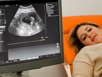 northwestern-medicine-mother-during-ultrasound-smiling